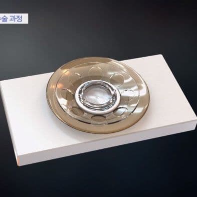 cornea {caption: 보스턴 인공각막}