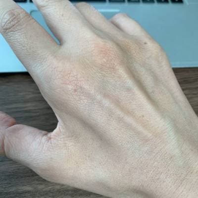 hand_crawled {caption: 갈퀴손 변형}
